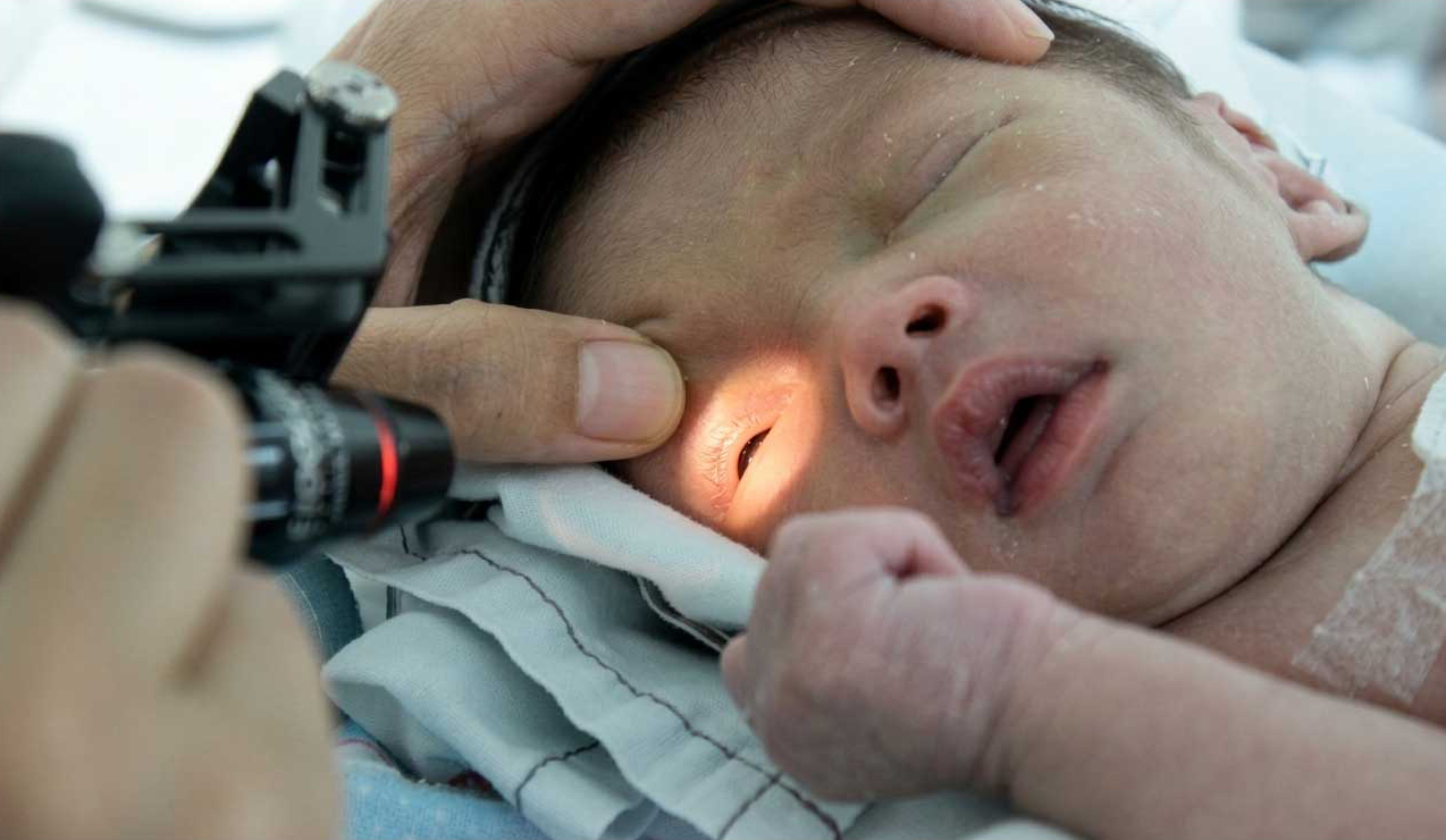 skrining-pada-mata-bayi-dan-anak